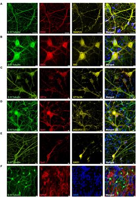 Embryonic Stem Cell-Derived Neurons Grown on Multi-Electrode Arrays as a Novel In vitro Bioassay for the Detection of Clostridium botulinum Neurotoxins